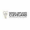 Dental Implants Cleveland